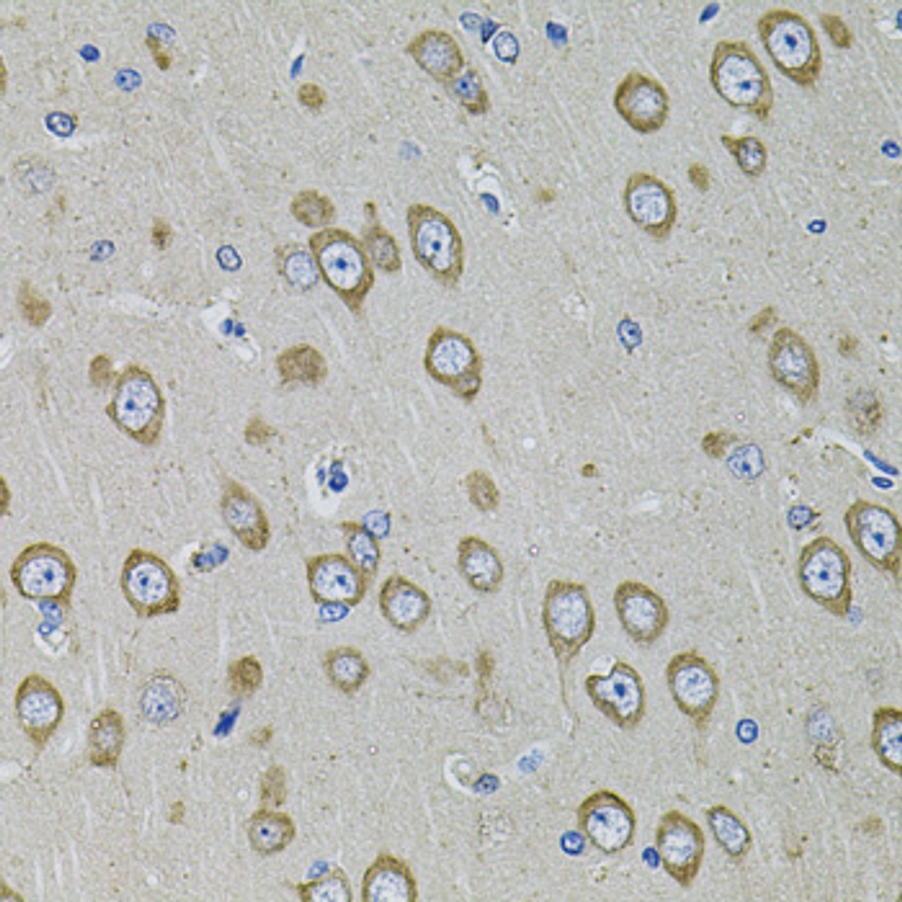 Immunohistochemistry of paraffin-embedded Rat brain using PDE1B Polyclonal Antibody at dilution of  1:100 (40x lens).