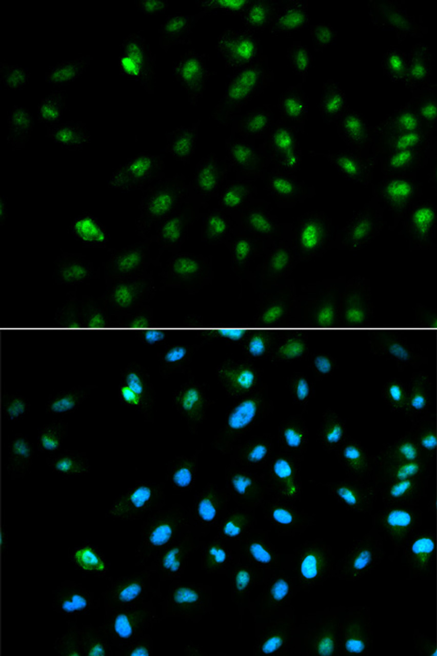 Immunofluorescence analysis of HepG2 cells using POLR2A Polyclonal Antibody