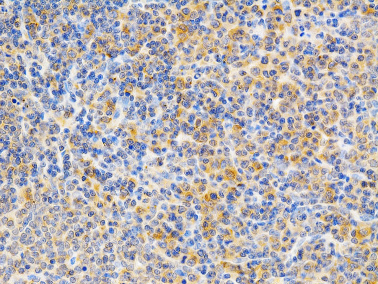 Immunohistochemistry of paraffin-embedded Rat spleen using PRKCE Polyclonal Antibody at dilution of  1:200 (40x lens).