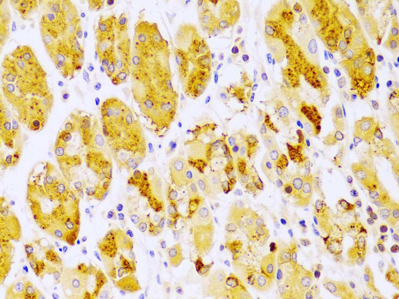 Immunohistochemistry of paraffin-embedded Human stomach using PRKCE Polyclonal Antibody at dilution of  1:100 (40x lens).