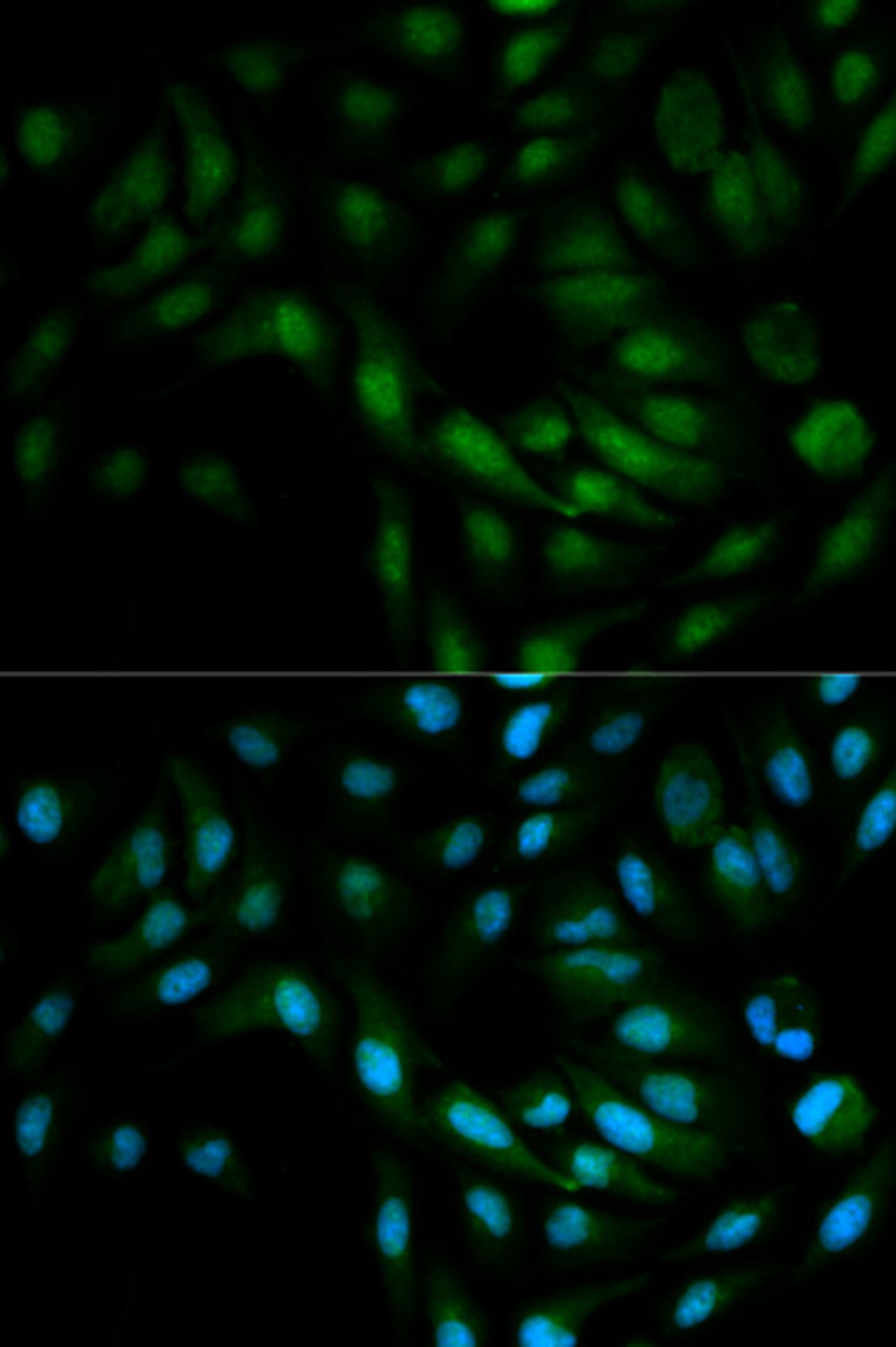 Immunofluorescence analysis of MCF-7 cells using MAPK7 Polyclonal Antibody