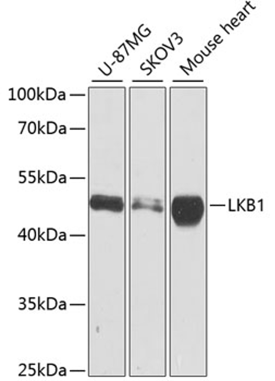 Western blot analysis of extracts of various cell lines using LKB1 Polyclonal Antibody at dilution of 1:1000.