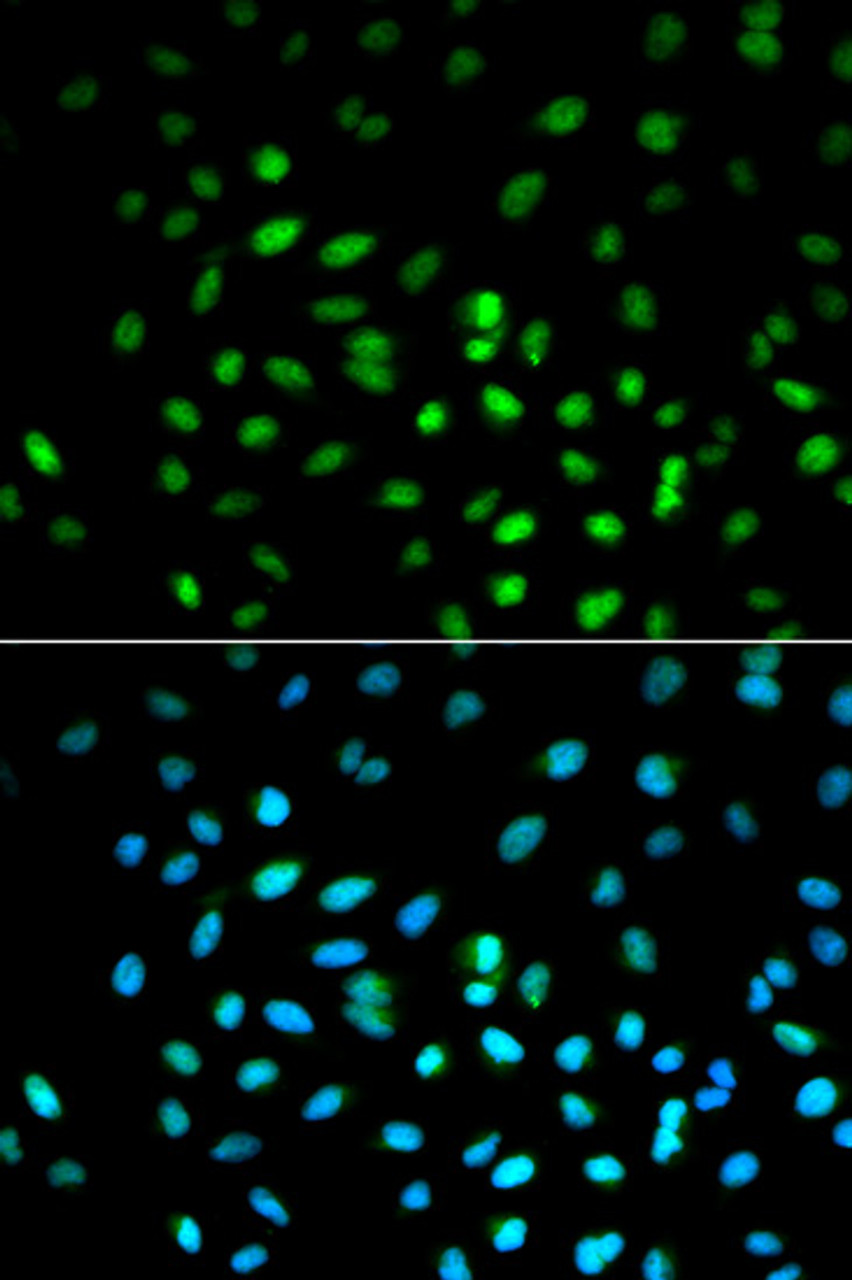 Immunofluorescence analysis of MCF-7 cells using LKB1 Polyclonal Antibody