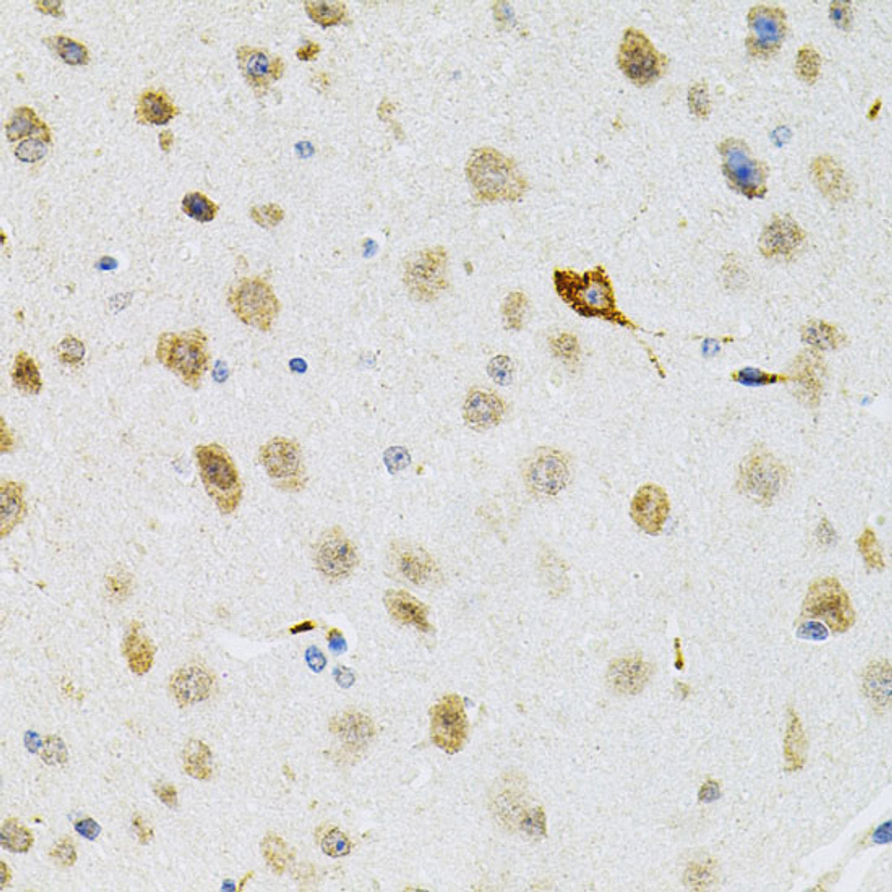 Immunohistochemistry of paraffin-embedded Mouse brain using SYK Polyclonal Antibody at dilution of  1:100 (40x lens).