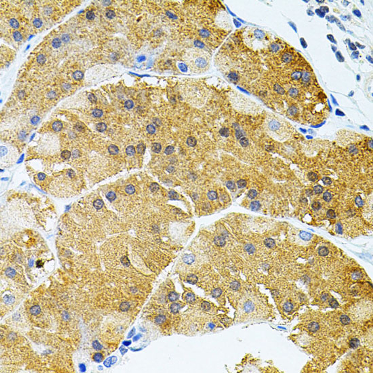 Immunohistochemistry of paraffin-embedded Human stomach using SYK Polyclonal Antibody at dilution of  1:100 (40x lens).