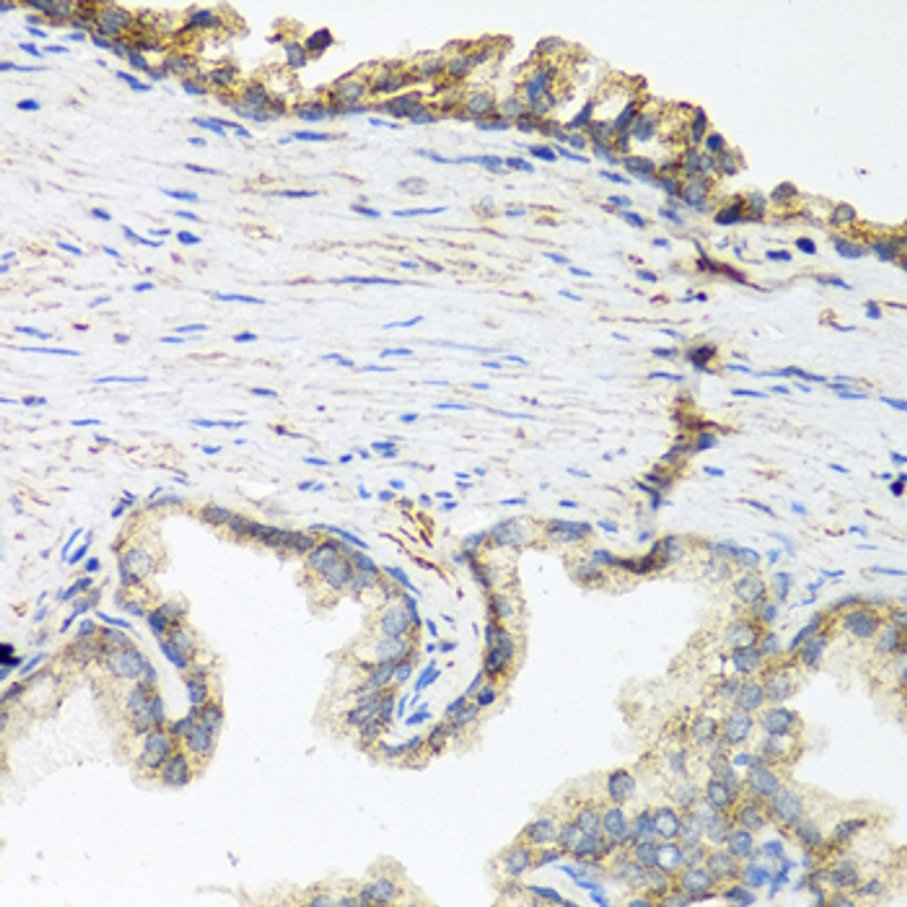 Immunohistochemistry of paraffin-embedded Human prostate using Wnt5a Polyclonal Antibody at dilution of  1:100 (40x lens).