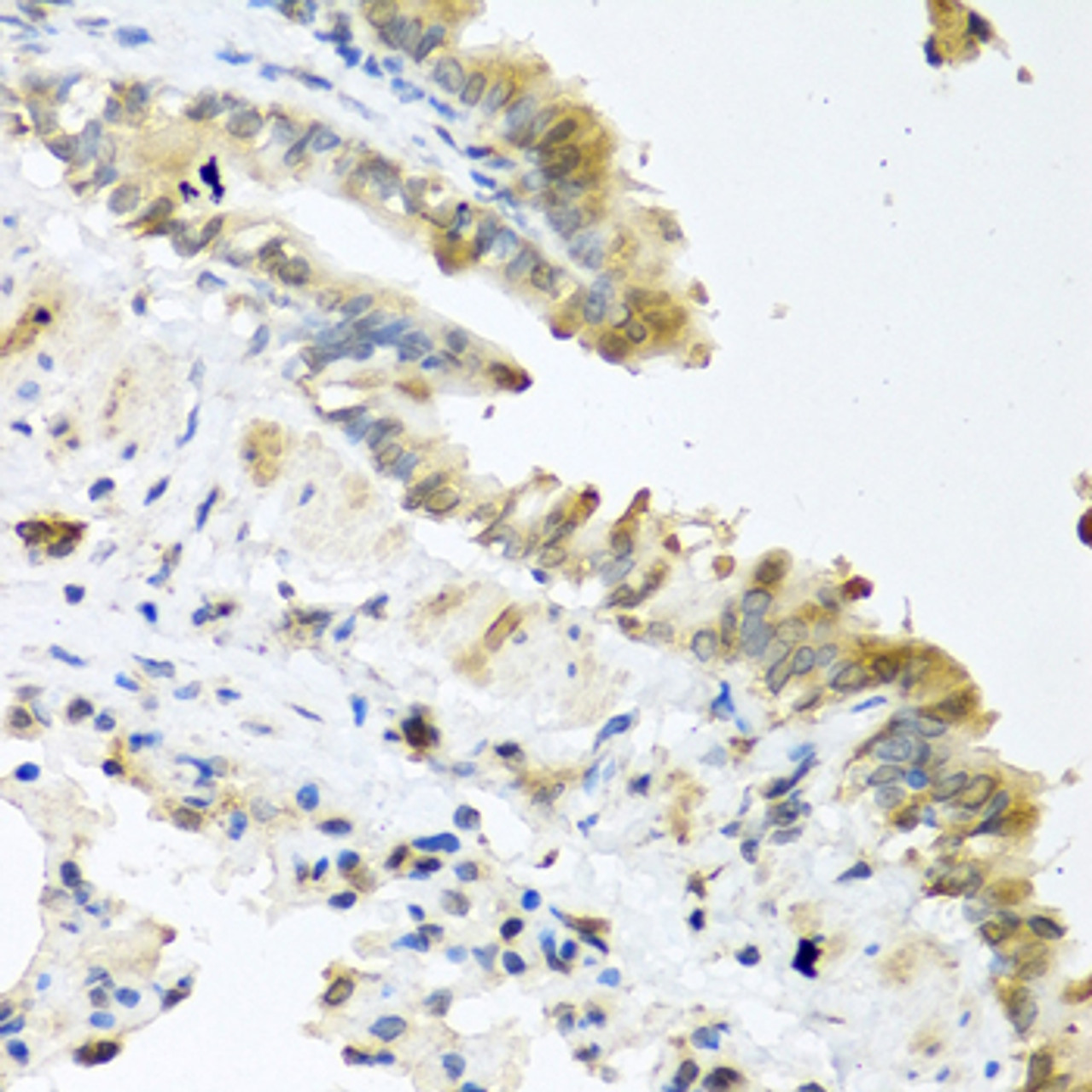 Immunohistochemistry of paraffin-embedded Mouse lung using Wnt5a Polyclonal Antibody at dilution of  1:100 (40x lens).