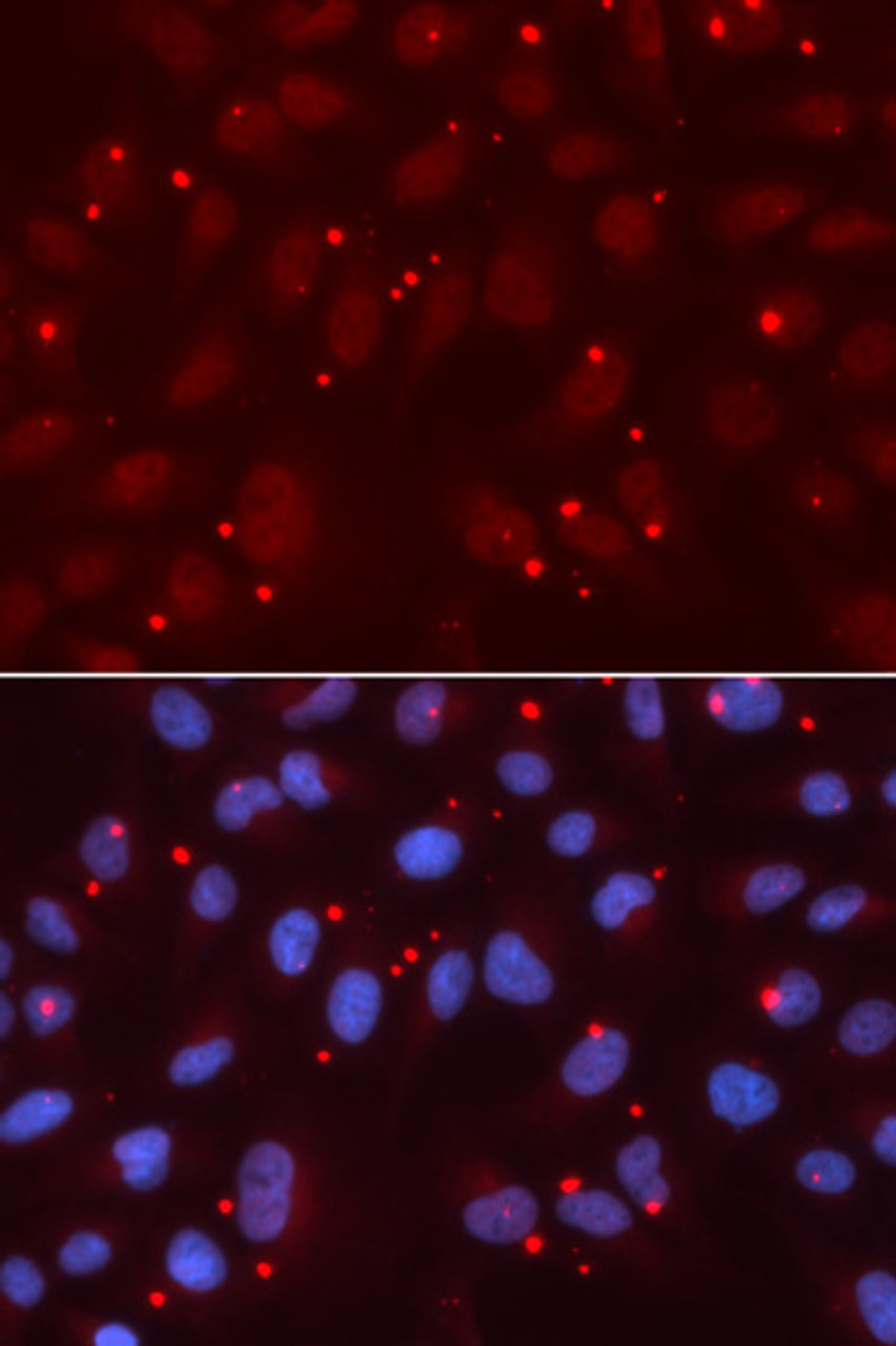 Immunofluorescence analysis of U2OS cells using XRCC3 Polyclonal Antibody