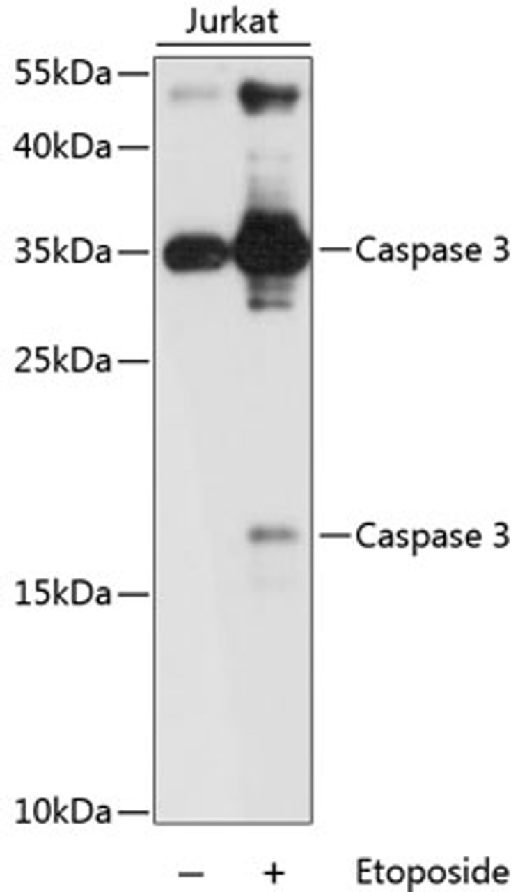 Western blot analysis of extracts of Jurkat cells using Caspase-3 Polyclonal Antibody at dilution of 1:1000.