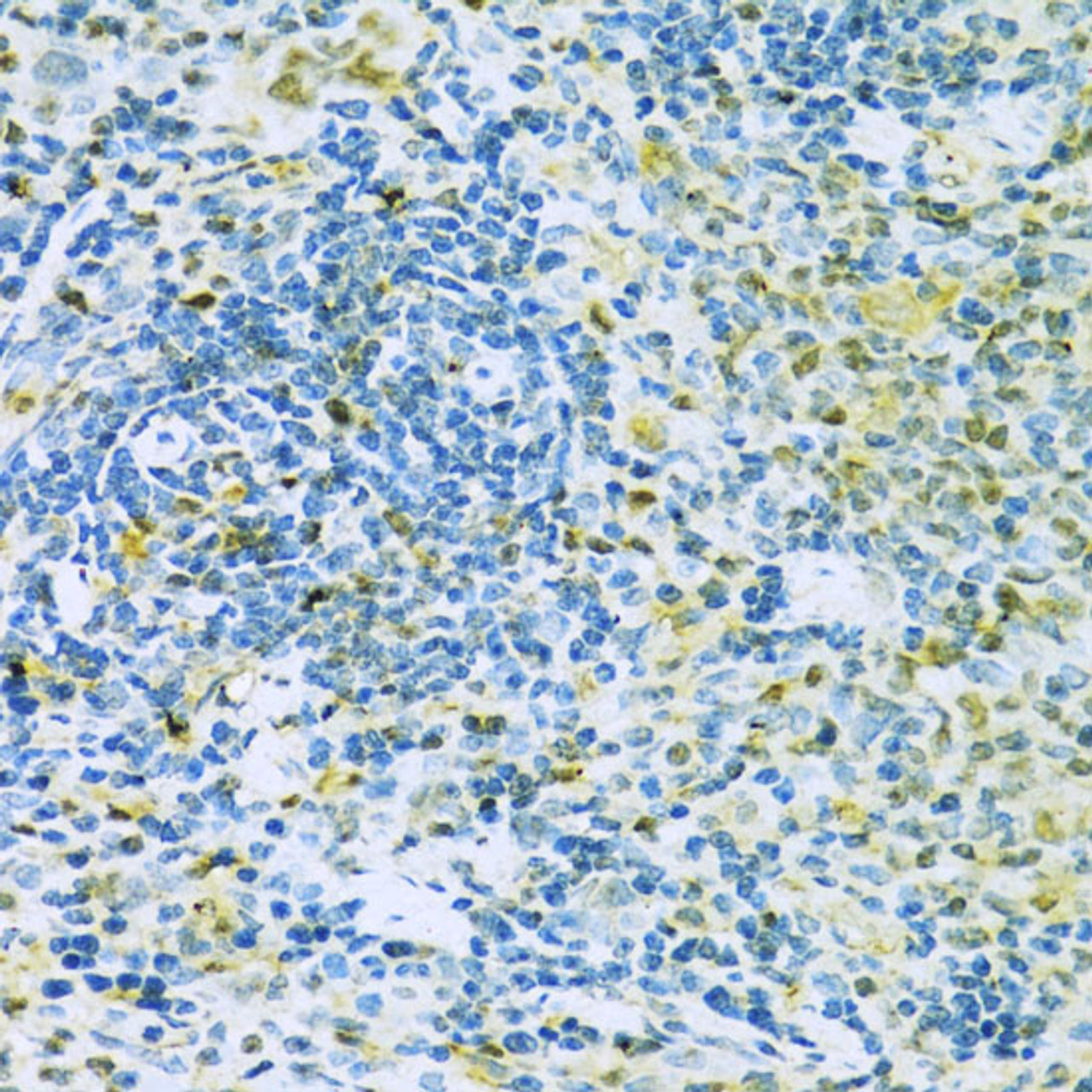 Immunohistochemistry of paraffin-embedded Rat spleen using Caspase-3 Polyclonal Antibody at dilution of  1:100 (40x lens).