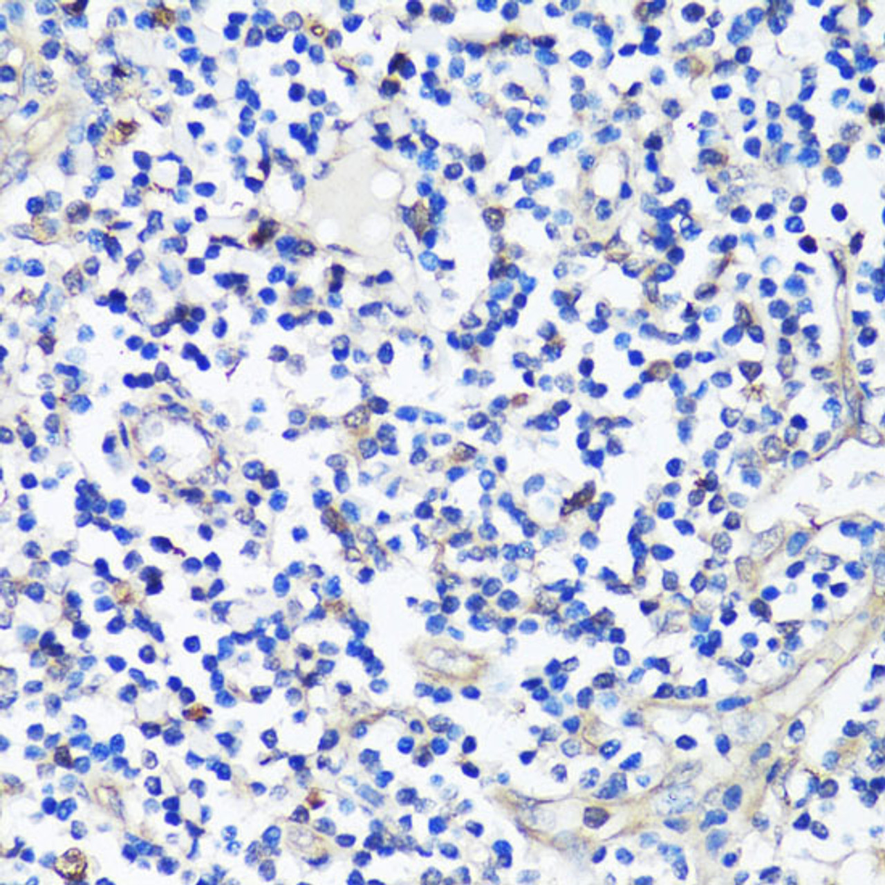 Immunohistochemistry of paraffin-embedded Human tonsil using Caspase-3 Polyclonal Antibody at dilution of  1:100 (40x lens).