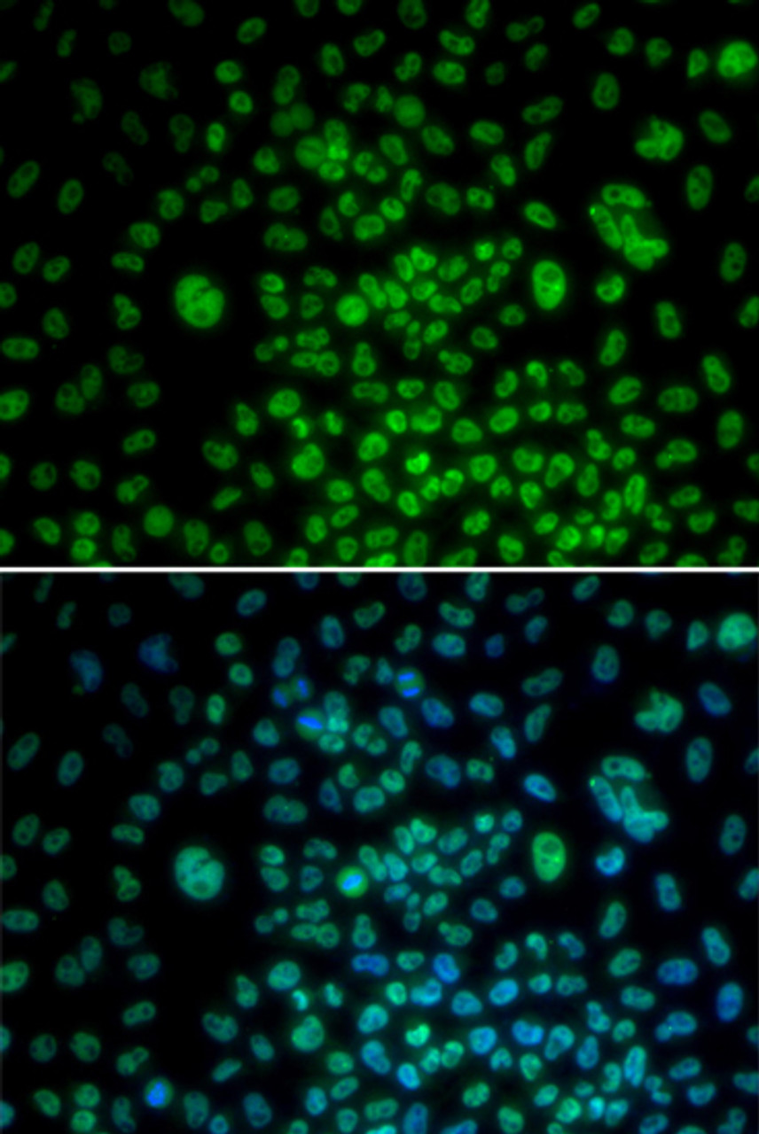 Immunofluorescence analysis of U2OS cells using MAX Polyclonal Antibody