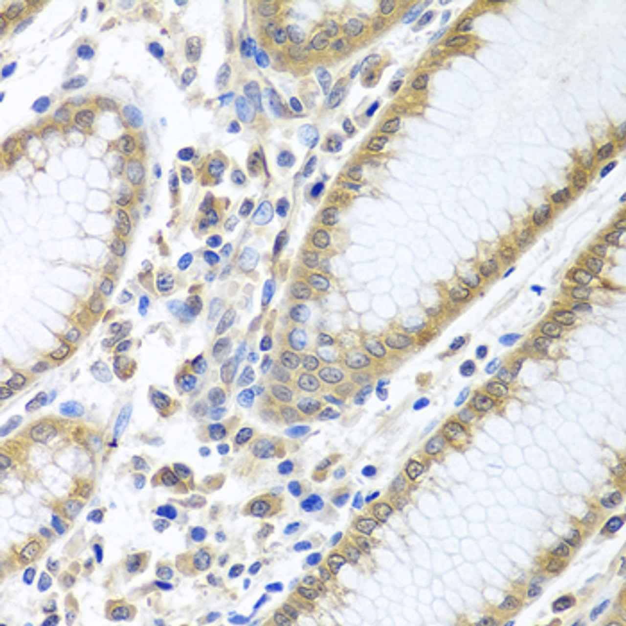 Immunohistochemistry of paraffin-embedded Human stomach using EIF4E Polyclonal Antibody at dilution of  1:100 (40x lens).