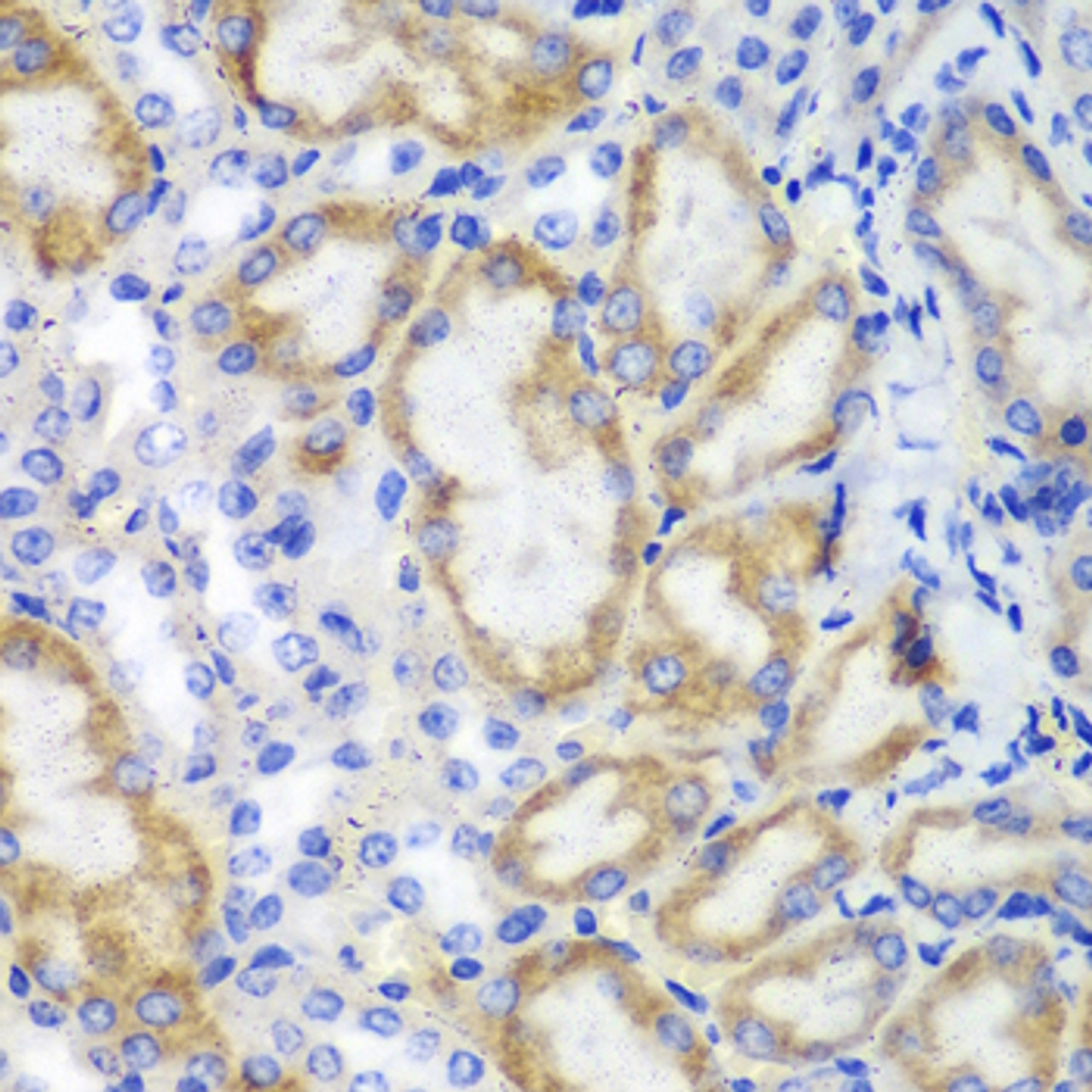 Immunohistochemistry of paraffin-embedded Mouse kidney using HCLS1 Polyclonal Antibody at dilution of  1:100 (40x lens).