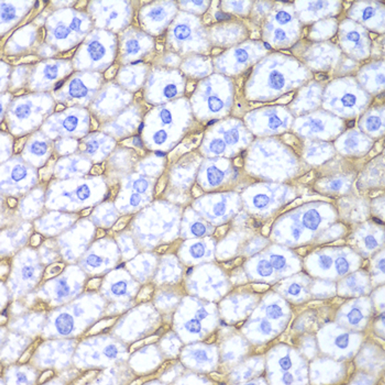 Immunohistochemistry of paraffin-embedded Mouse liver using HLA-A Polyclonal Antibody at dilution of  1:100 (40x lens).