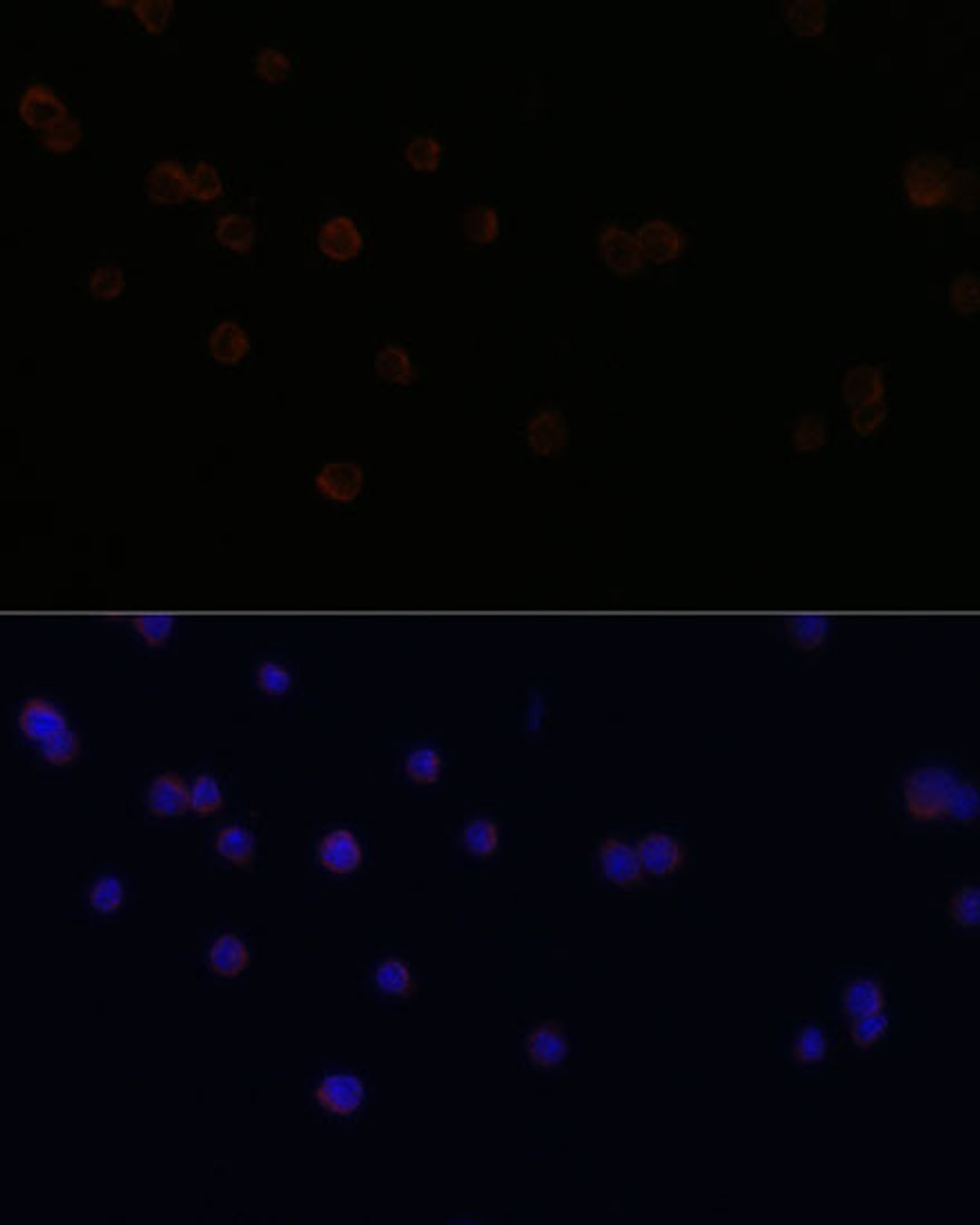 Immunofluorescence analysis of RAW264.7 cells using CD18 Polyclonal Antibody at dilution of  1:100. Blue: DAPI for nuclear staining.