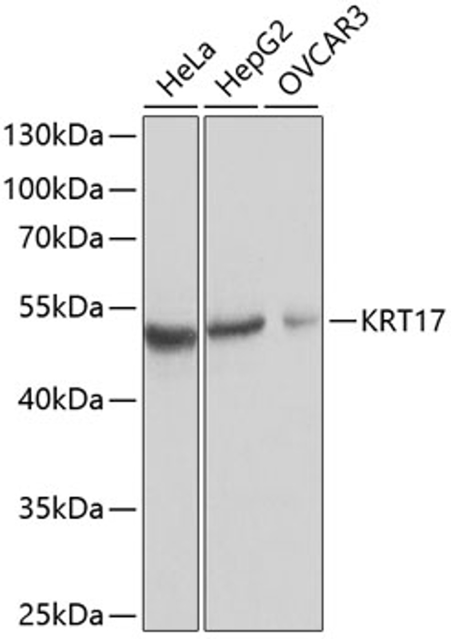 Western blot analysis of extracts of various cell lines using KRT17 Polyclonal Antibody at dilution of 1:1000.