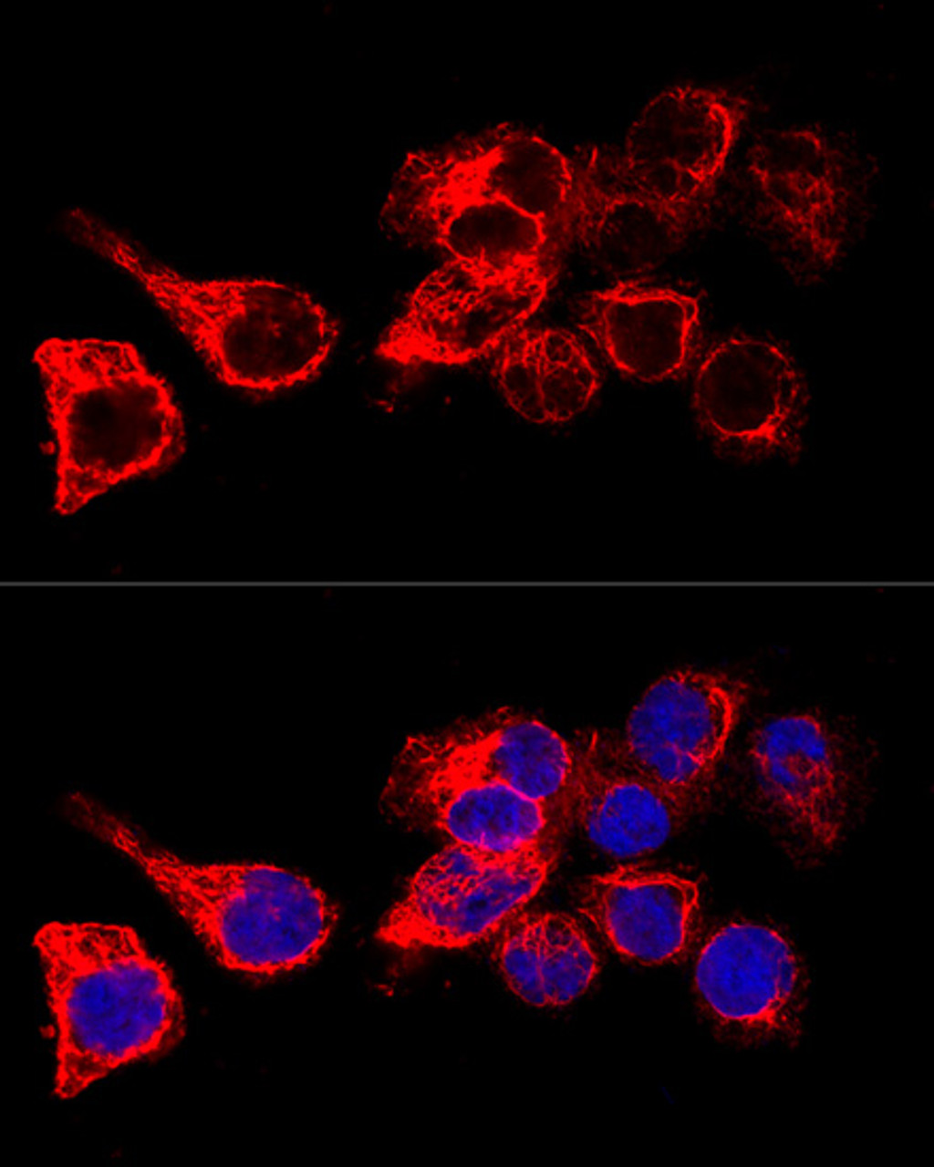 Confocal immunofluorescence analysis of HeLa cells using KRT17 Polyclonal Antibody at dilution of  1:200. Blue: DAPI for nuclear staining.