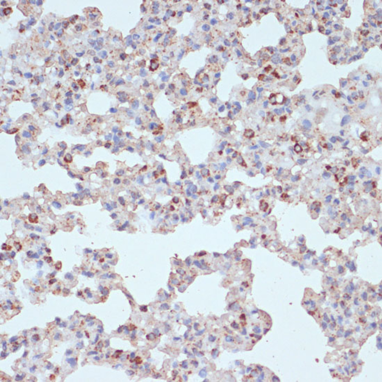 Immunohistochemistry of paraffin-embedded Rat lung using PDGFR beta Polyclonal Antibody at dilution of  1:100 (40x lens).