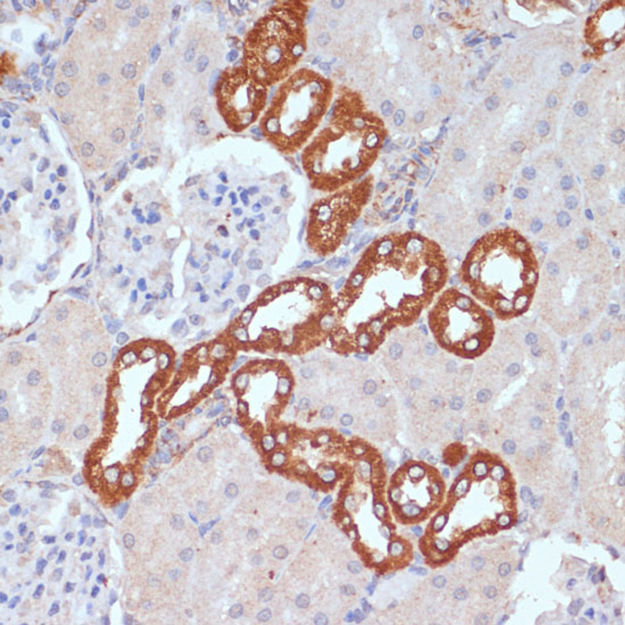 Immunohistochemistry of paraffin-embedded Rat kidney using PDGFR beta Polyclonal Antibody at dilution of  1:100 (40x lens).