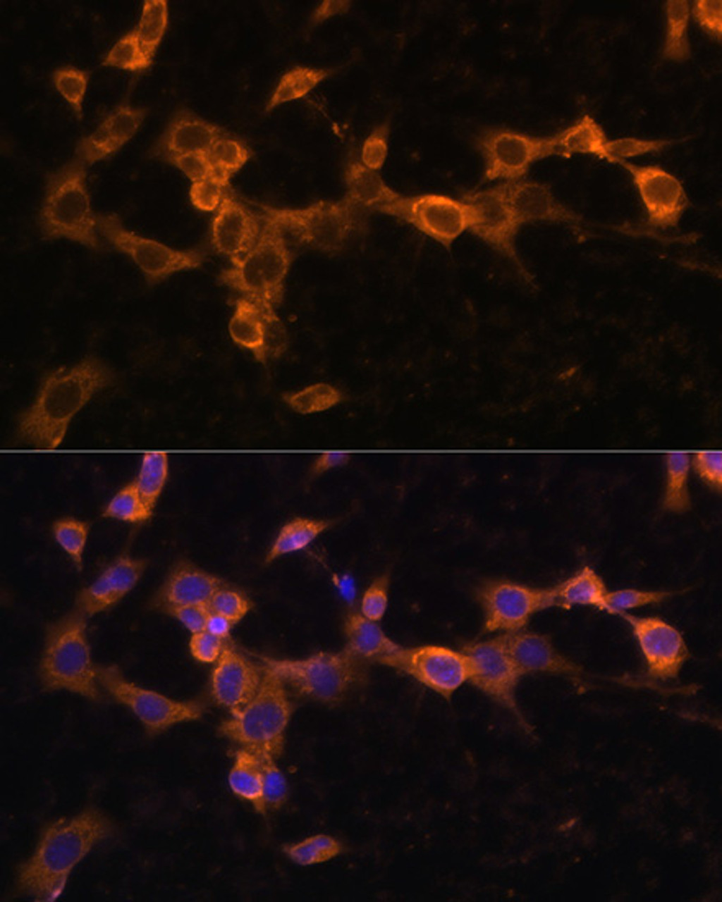 Immunofluorescence analysis of NIH/3T3 cells using PDGFR beta Polyclonal Antibody at dilution of  1:100. Blue: DAPI for nuclear staining.