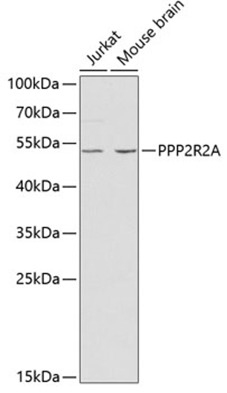 Western blot analysis of extracts of various cell lines using PPP2R2A Polyclonal Antibody at dilution of 1:1000.