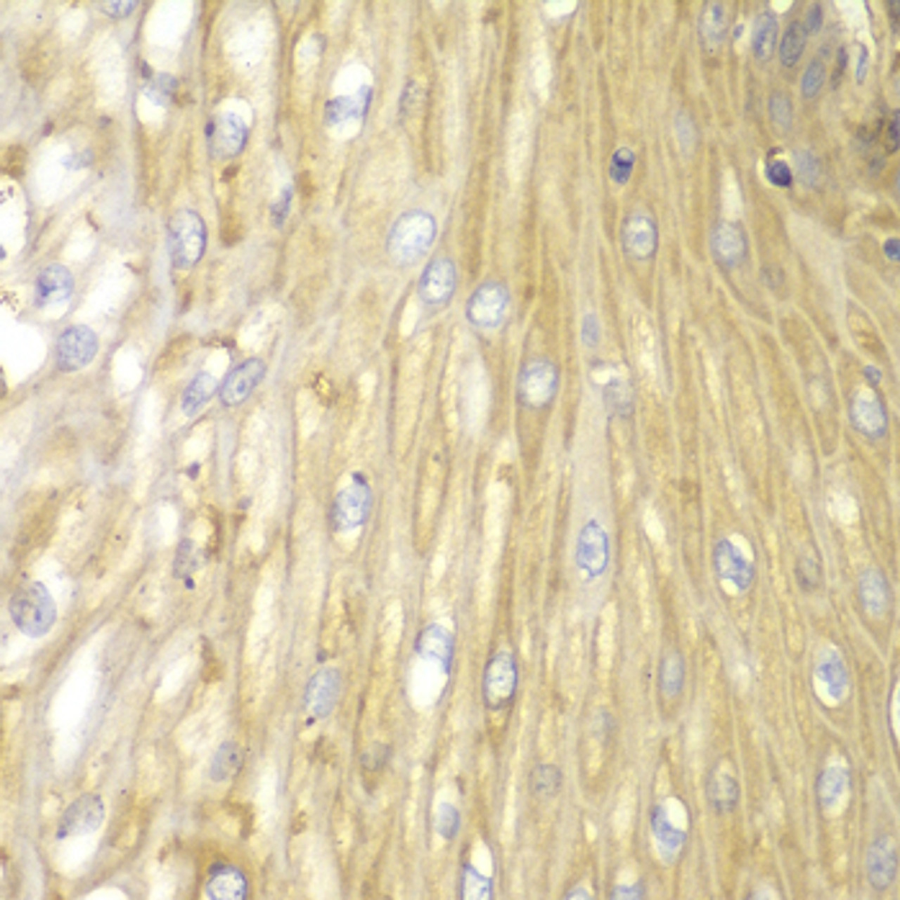 Immunohistochemistry of paraffin-embedded Human esophagus using PPP2R2A Polyclonal Antibody at dilution of  1:100 (40x lens).