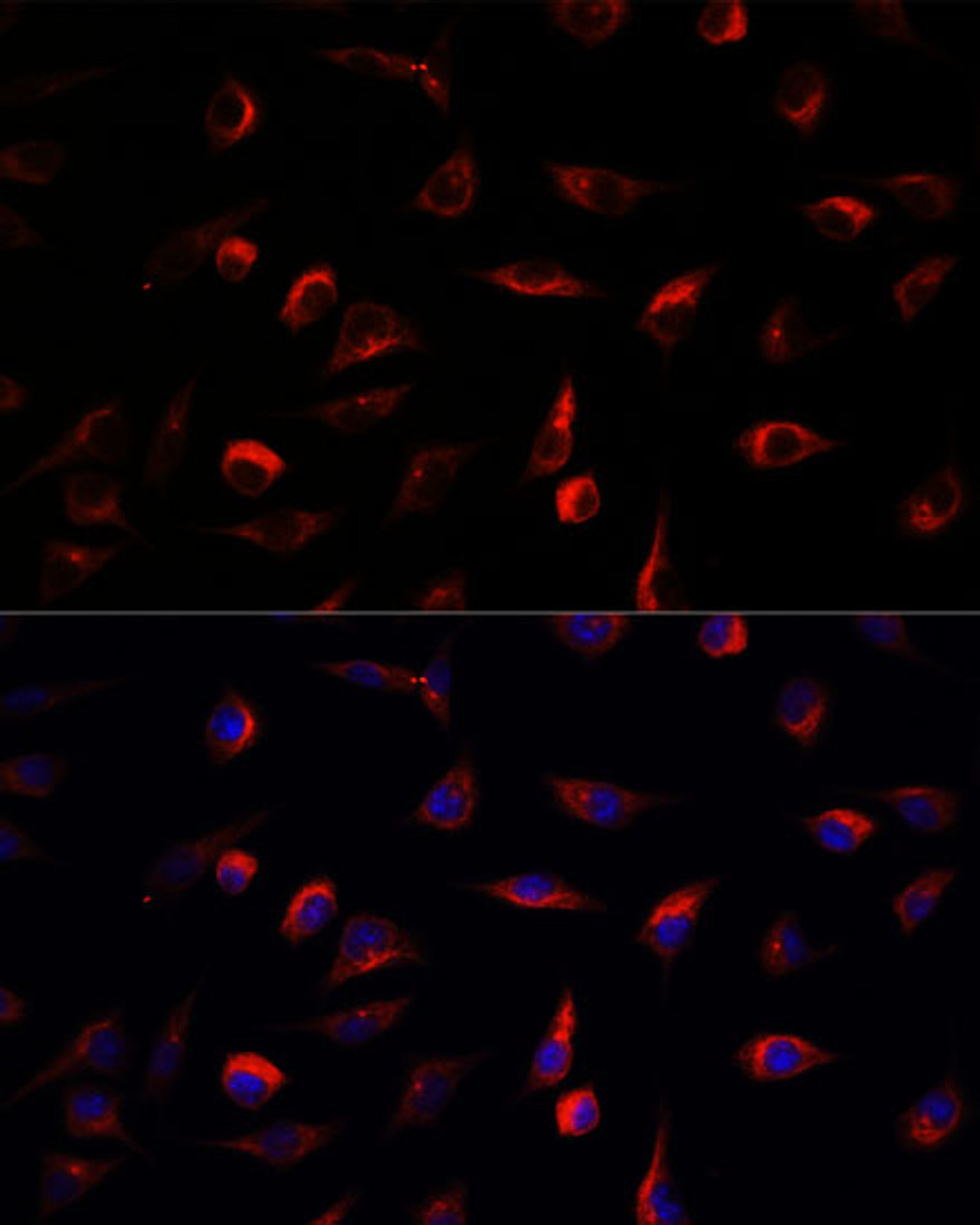 Immunofluorescence analysis of L929 cells using MAP2K7 Polyclonal Antibody at dilution of  1:100. Blue: DAPI for nuclear staining.
