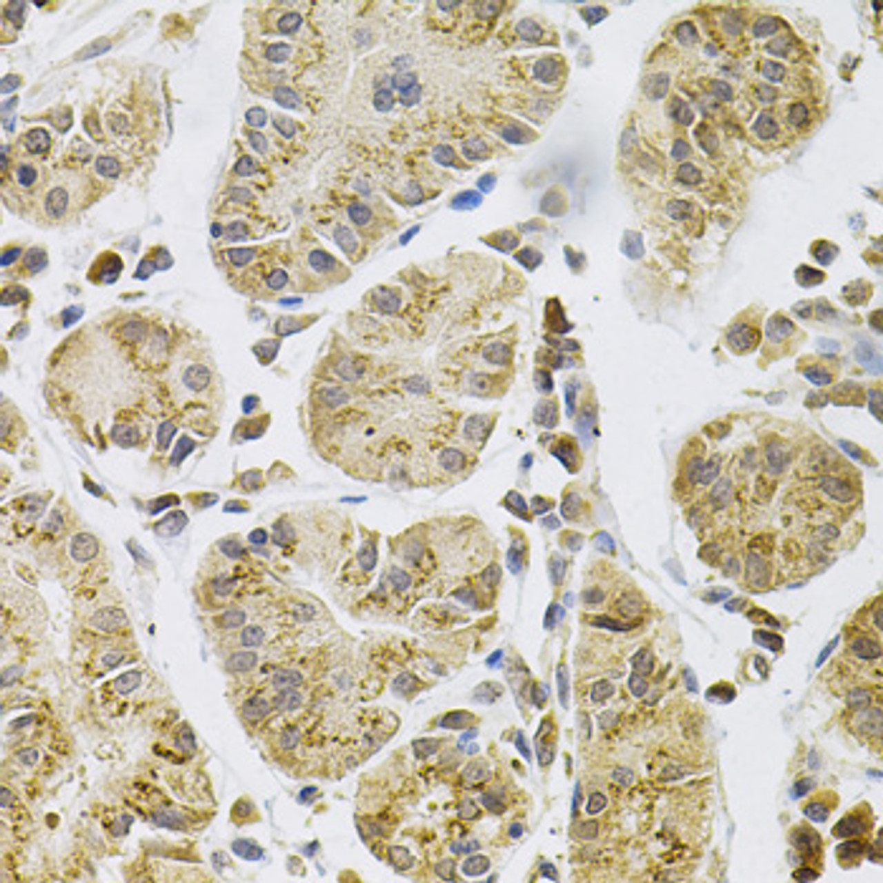 Immunohistochemistry of paraffin-embedded Human stomach using PSEN1 Polyclonal Antibody at dilution of  1:100 (40x lens).