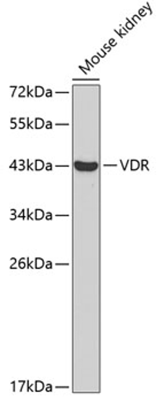 Western blot analysis of extracts of Mouse kidney using VDR Polyclonal Antibody at dilution of 1:1000.