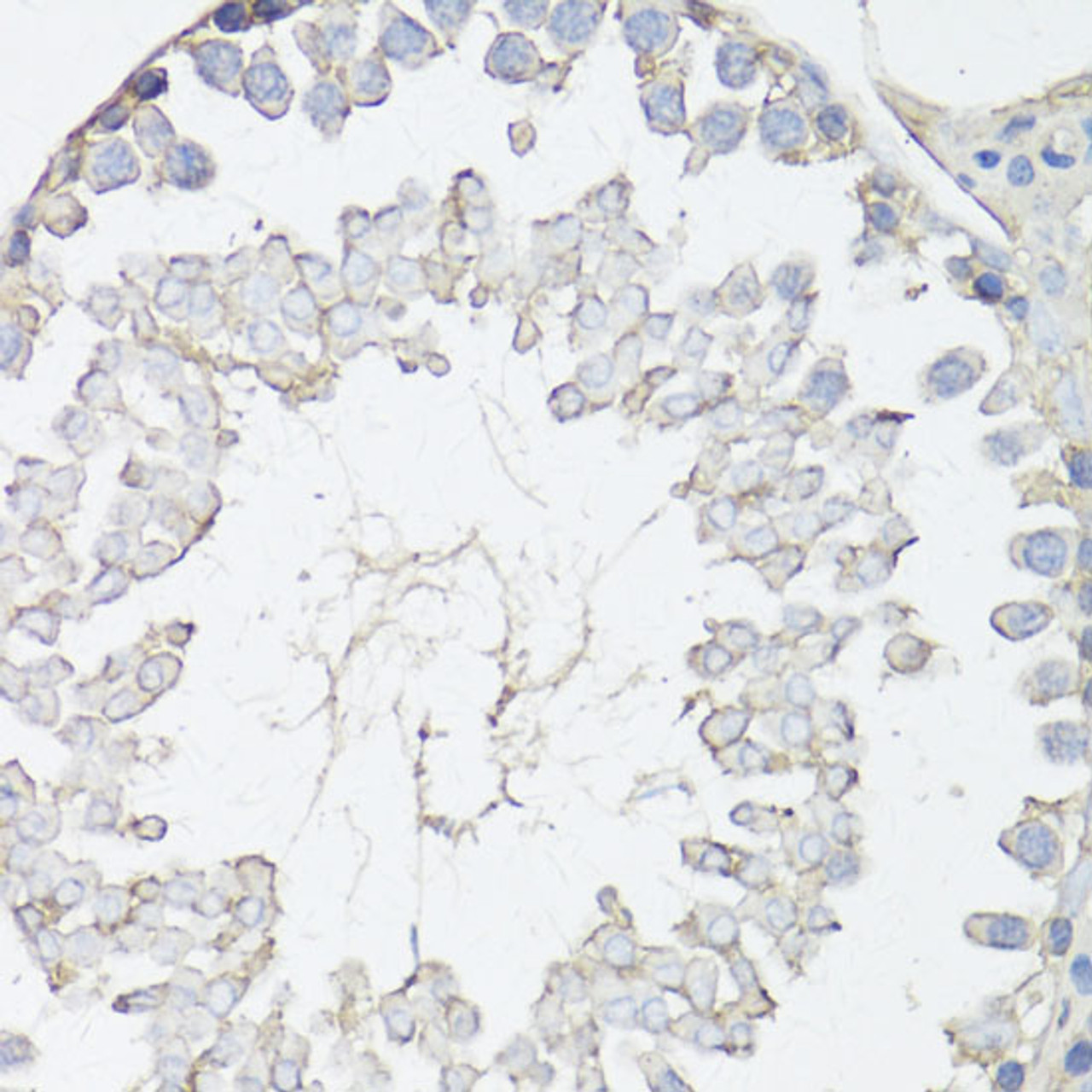 Immunohistochemistry of paraffin-embedded Rat testis using MRP4 / ABCC4 Polyclonal Antibody at dilution of  1:150 (40x lens).