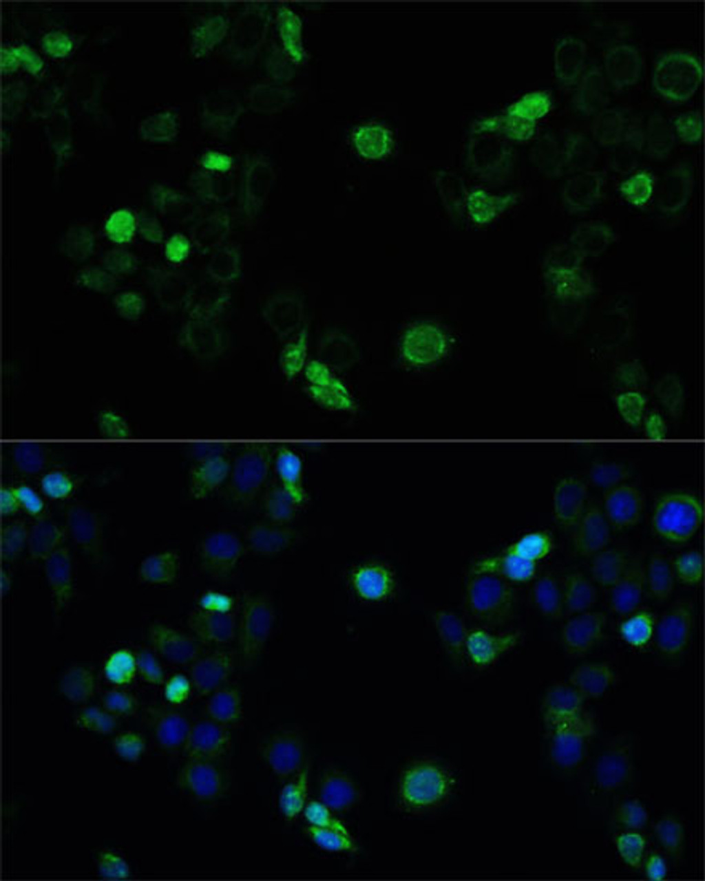 Immunofluorescence analysis of HeLa cells using MRP4 / ABCC4 Polyclonal Antibody at dilution of  1:100. Blue: DAPI for nuclear staining.