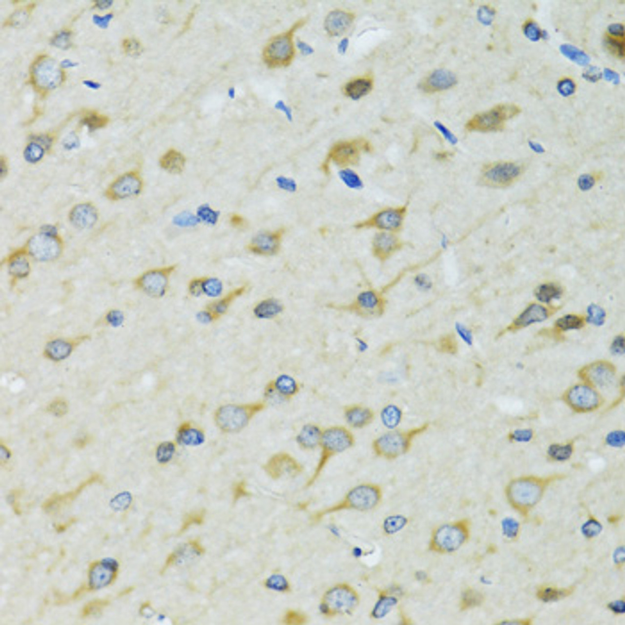 Immunohistochemistry of paraffin-embedded Rat brain using DCTN2 Polyclonal Antibody at dilution of  1:100 (40x lens).
