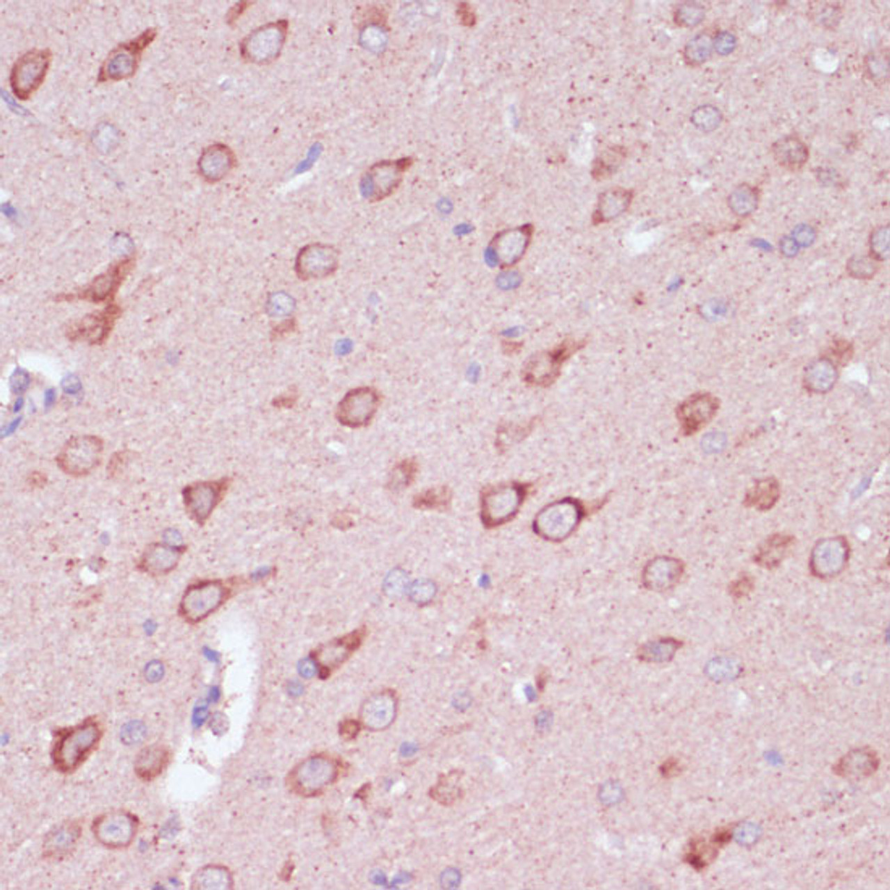 Immunohistochemistry of paraffin-embedded Rat brain using TOLLIP Polyclonal Antibody at dilution of  1:100 (40x lens).