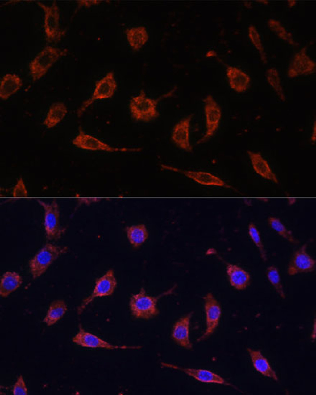 Immunofluorescence analysis of L929 cells using TOLLIP Polyclonal Antibody at dilution of  1:100. Blue: DAPI for nuclear staining.