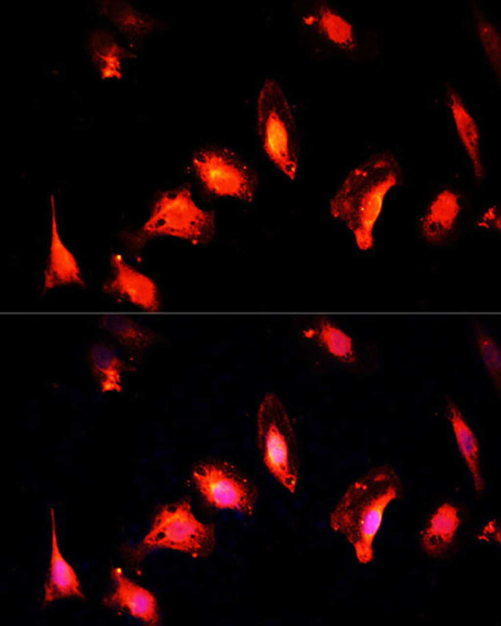 Immunofluorescence analysis of U-2 OS cells using MYST1 Polyclonal Antibody at dilution of  1:100 (40x lens). Blue: DAPI for nuclear staining.