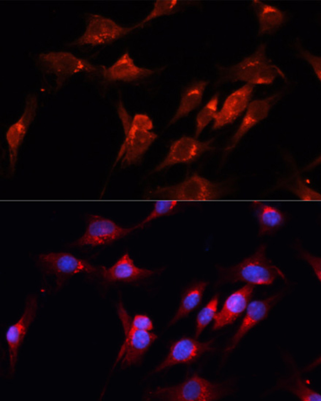 Immunofluorescence analysis of C6 cells using CUX1 Polyclonal Antibody at dilution of  1:100. Blue: DAPI for nuclear staining.