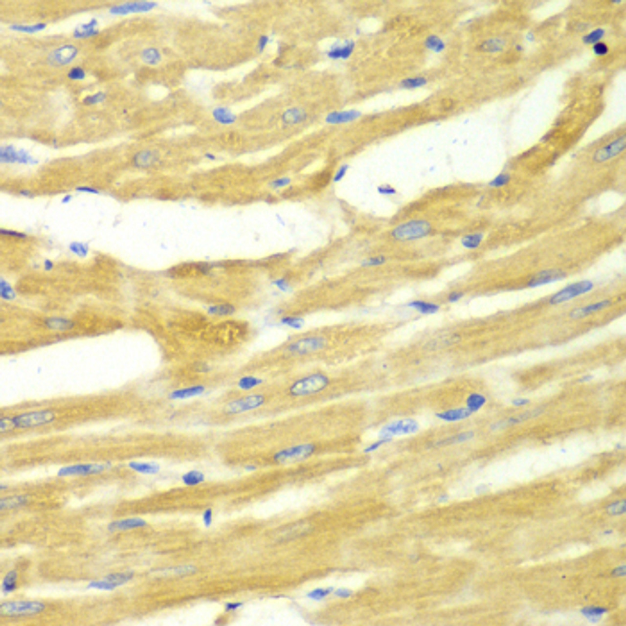Immunohistochemistry of paraffin-embedded Rat heart using OGT Polyclonal Antibody at dilution of  1:100 (40x lens).