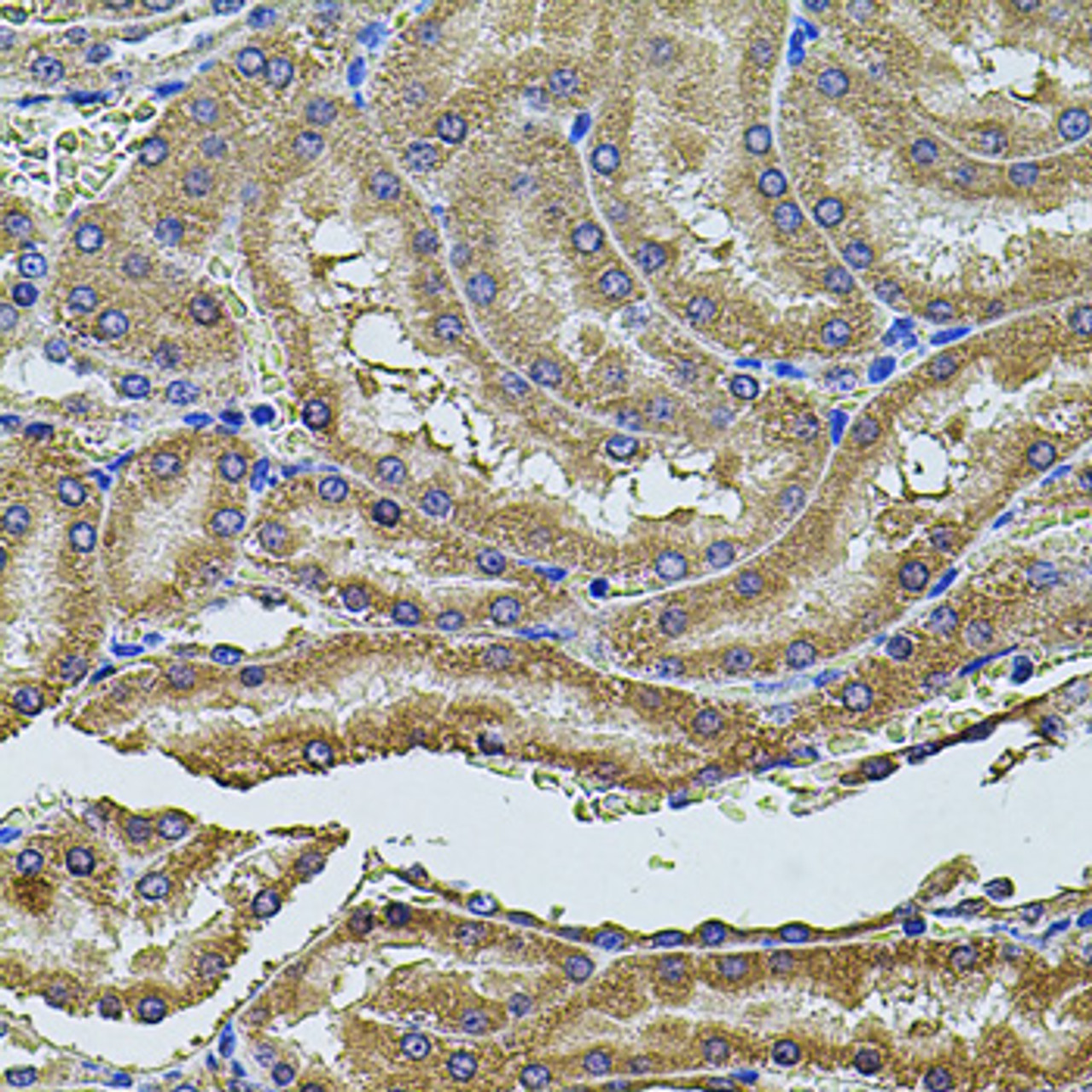 Immunohistochemistry of paraffin-embedded Rat kidney using ALIX / PDCD6IP Polyclonal Antibody at dilution of  1:100 (40x lens).