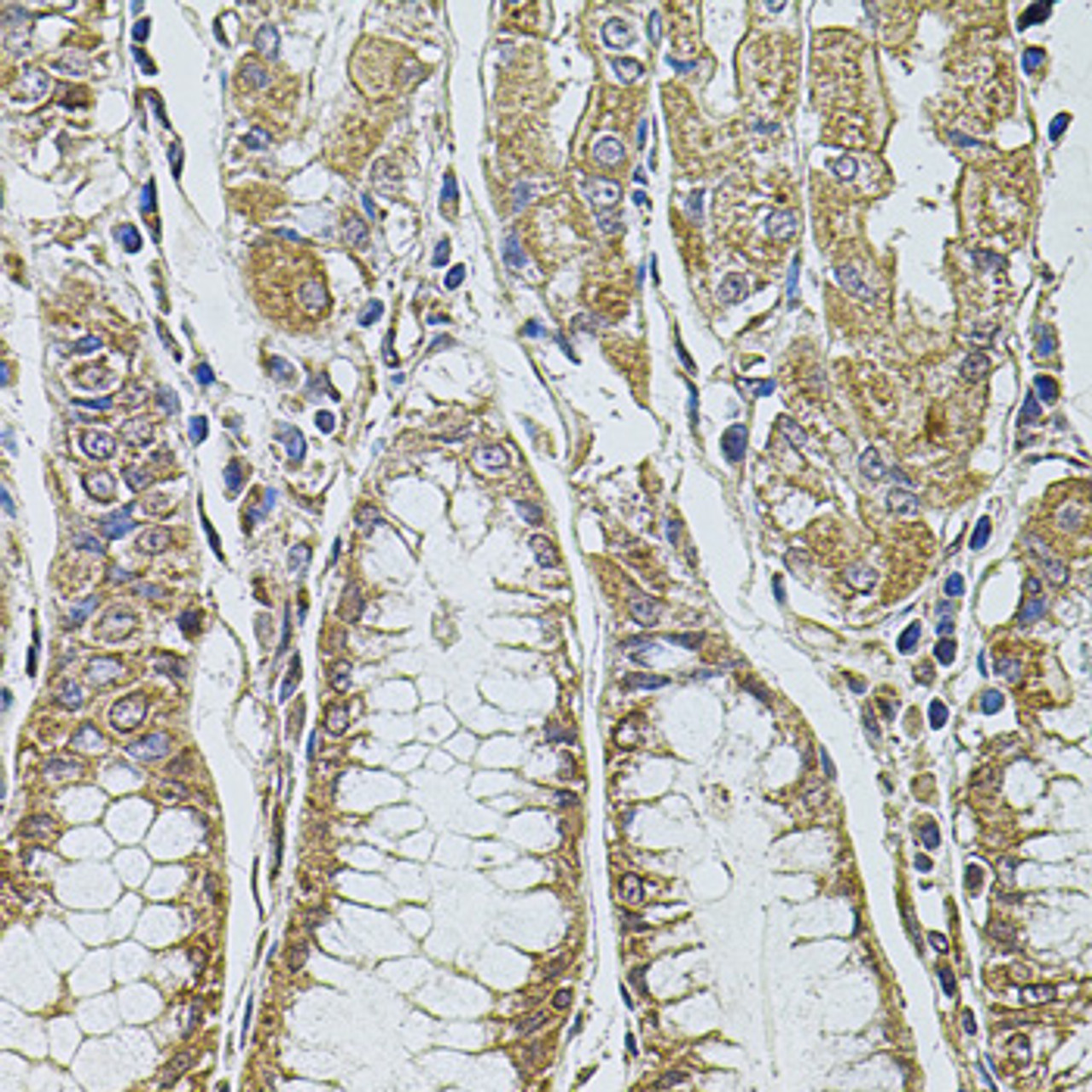 Immunohistochemistry of paraffin-embedded Human stomach using ALIX / PDCD6IP Polyclonal Antibody at dilution of  1:100 (40x lens).