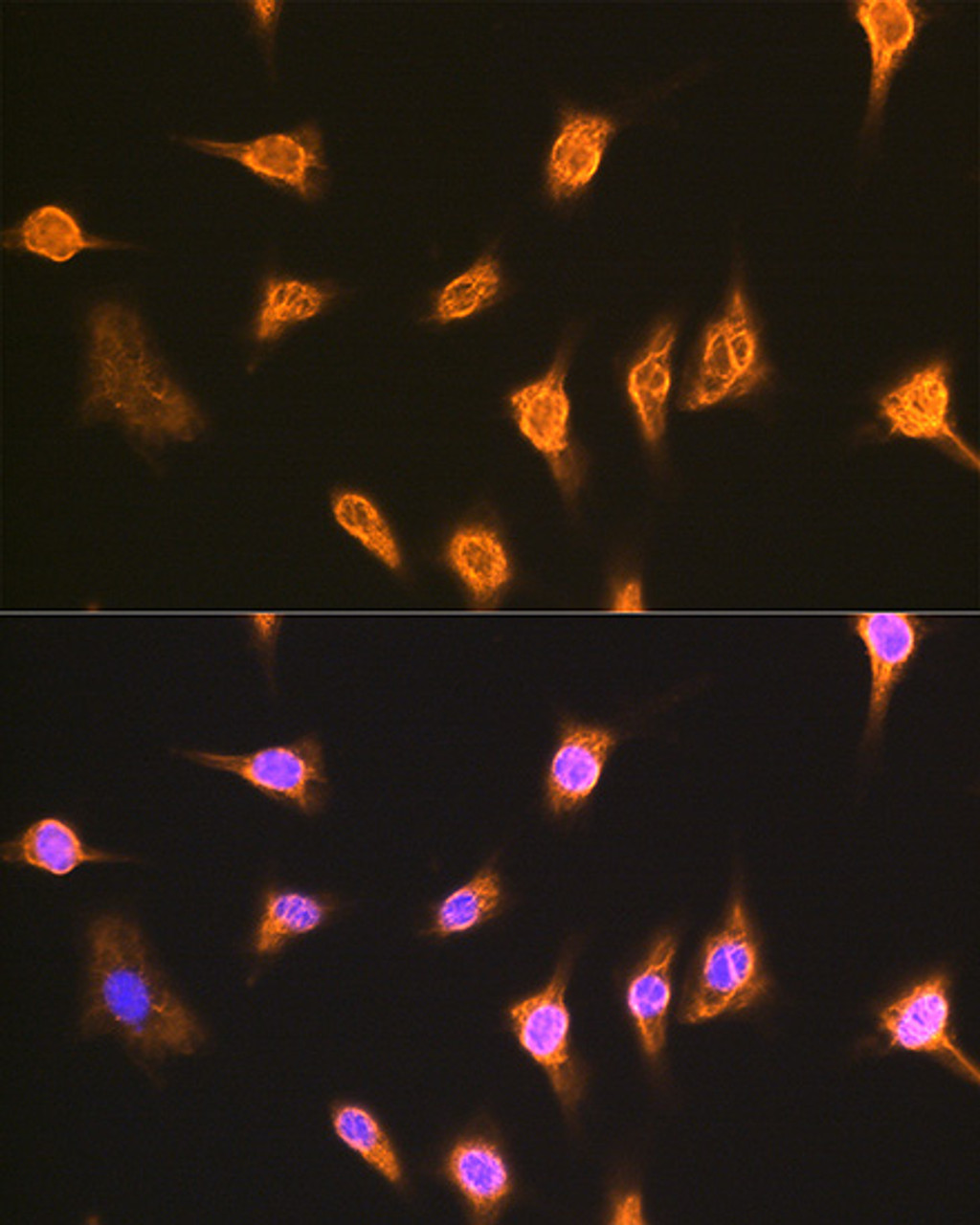 Immunofluorescence analysis of L929 cells using ALIX / PDCD6IP Polyclonal Antibody at dilution of  1:100. Blue: DAPI for nuclear staining.