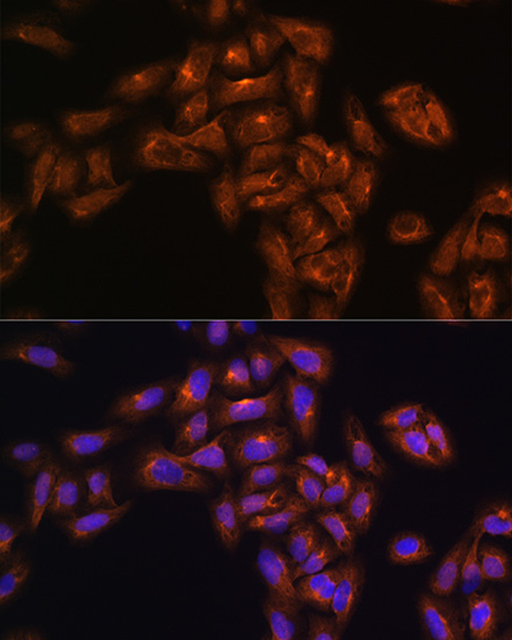 Immunofluorescence analysis of U-251MG cells using ALIX / PDCD6IP Polyclonal Antibody at dilution of  1:100. Blue: DAPI for nuclear staining.