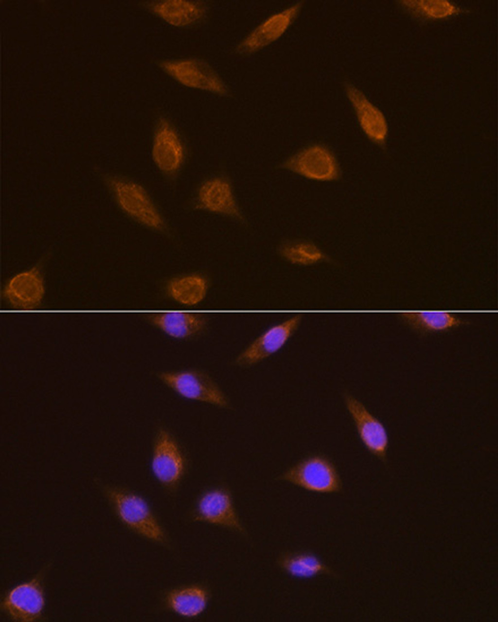 Immunofluorescence analysis of L929 cells using TSG101 Polyclonal Antibody at dilution of  1:100. Blue: DAPI for nuclear staining.