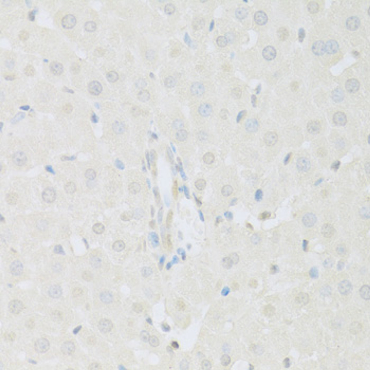 Immunohistochemistry of paraffin-embedded Rat liver using KAT2A Polyclonal Antibody at dilution of  1:100 (40x lens).