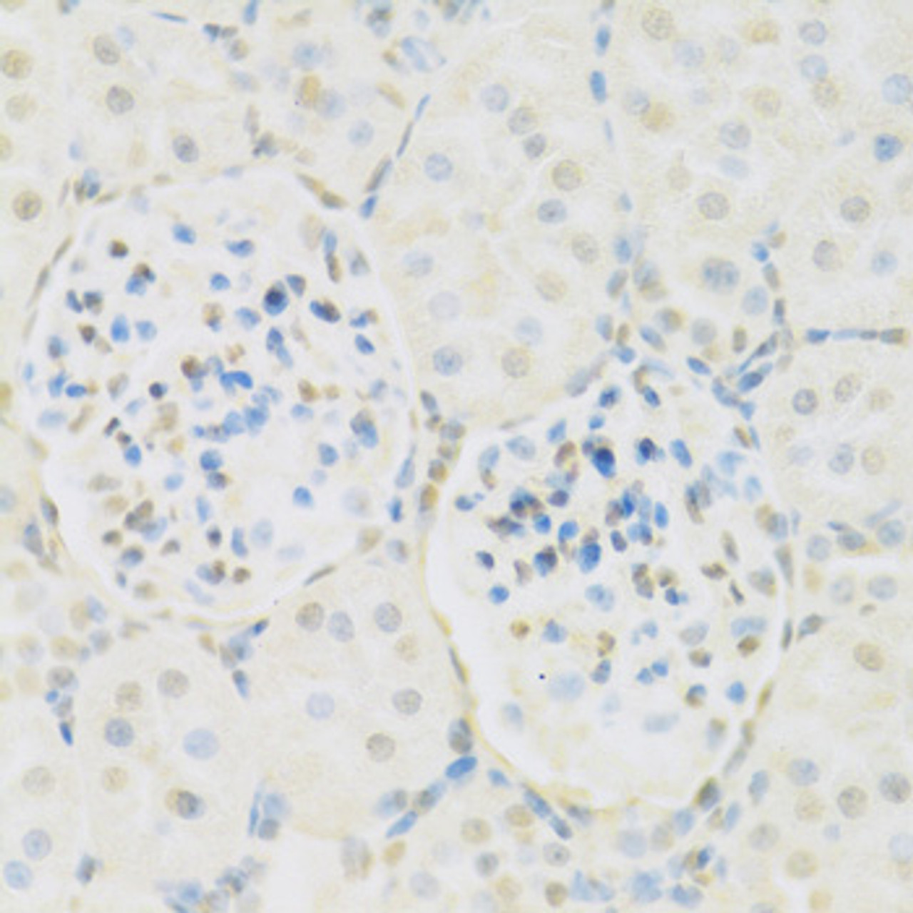 Immunohistochemistry of paraffin-embedded Rat kidney using KAT2A Polyclonal Antibody at dilution of  1:100 (40x lens).