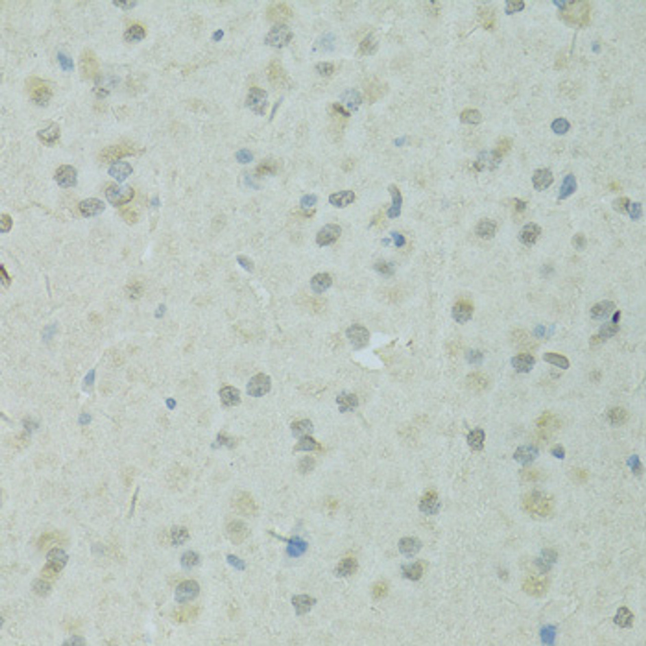 Immunohistochemistry of paraffin-embedded Rat brain using TRIM28 Polyclonal Antibody at dilution of  1:100 (40x lens).