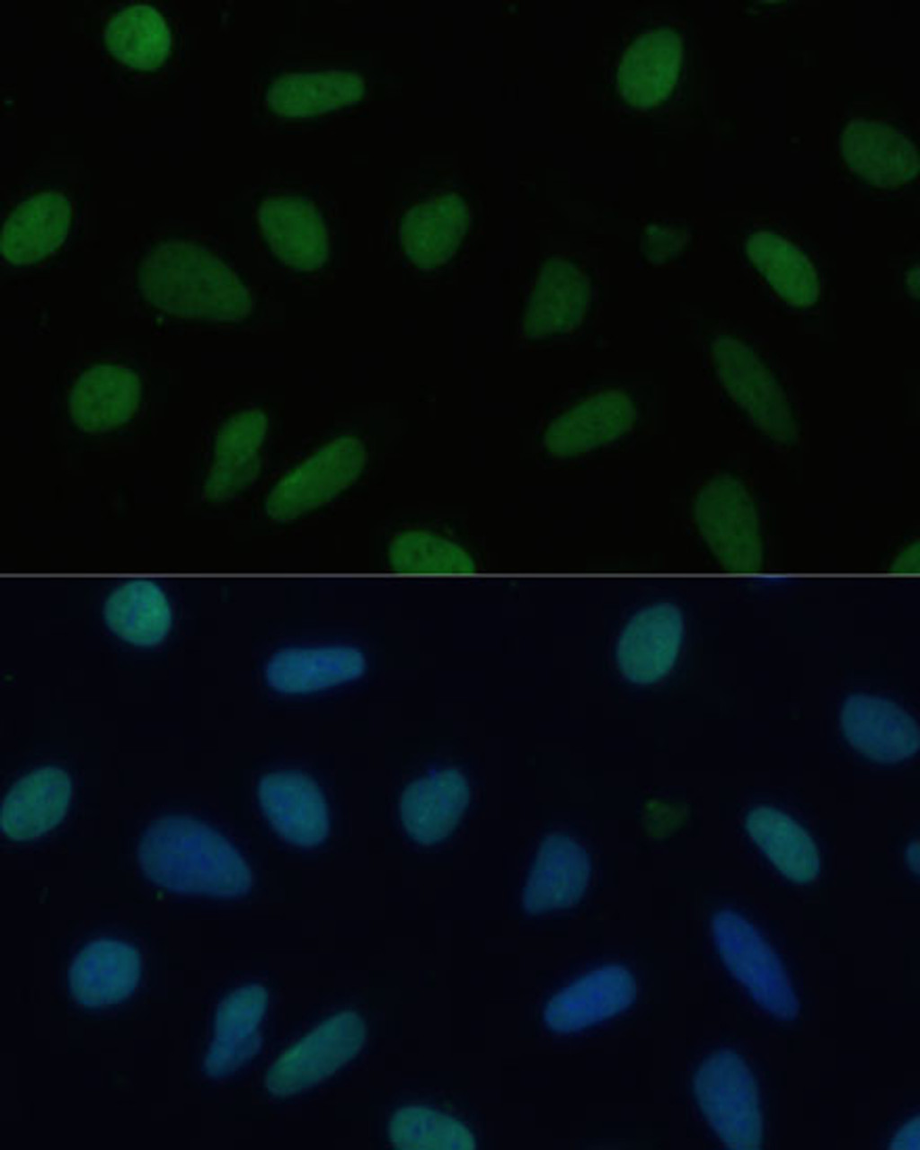 Immunofluorescence analysis of U-2 OS cells using TRIM28 Polyclonal Antibody at dilution of  1:100 (40x lens). Blue: DAPI for nuclear staining.
