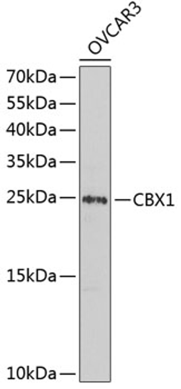 Western blot analysis of extracts of OVCAR-3 cells using CBX1 Polyclonal Antibody at dilution of 1:1000.