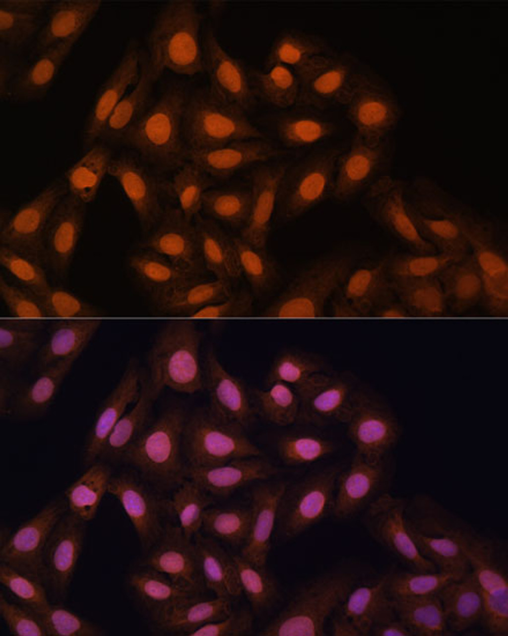 Immunofluorescence analysis of U-2 OS cells using CBX3 Polyclonal Antibody at dilution of  1:100. Blue: DAPI for nuclear staining.