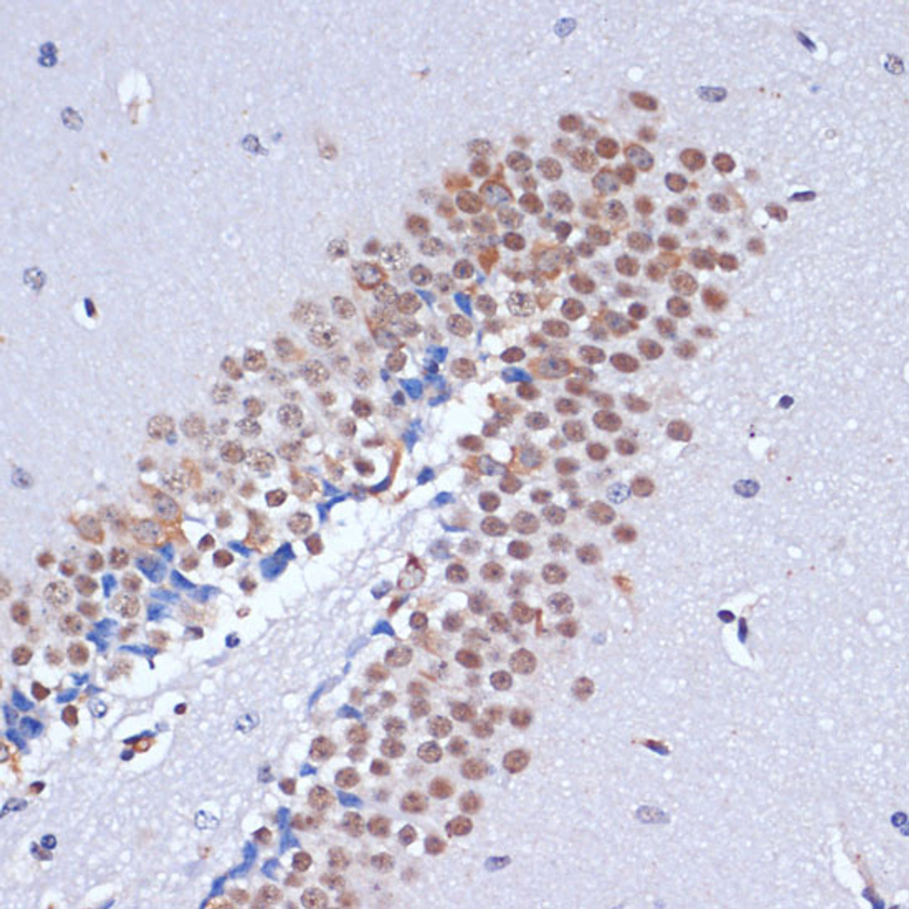 Immunohistochemistry of paraffin-embedded Mouse brain using DNMT3L Polyclonal Antibody at dilution of  1:100 (40x lens).